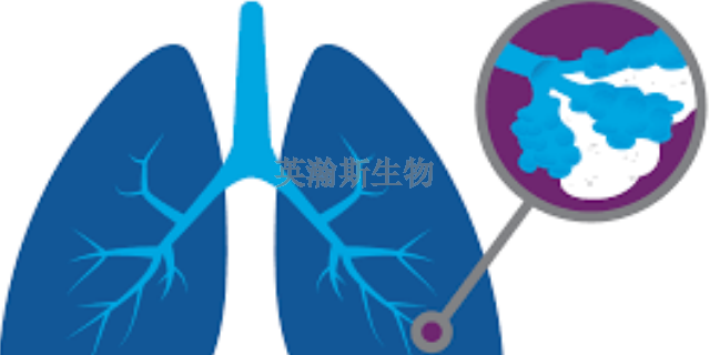 内蒙古靠谱的肺纤维化模型动物实验外包,肺纤维化模型