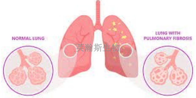 福建靠谱的肺纤维化模型是哪家,肺纤维化模型