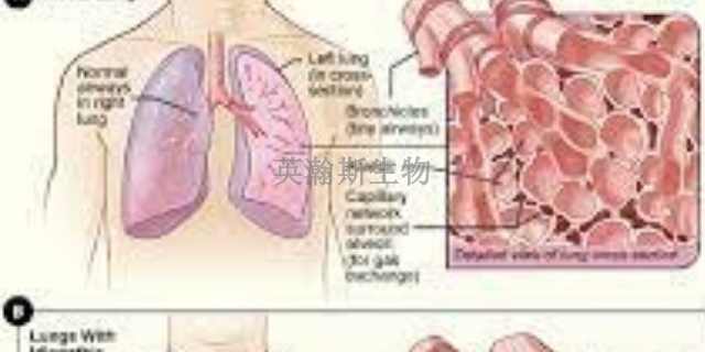 福建靠谱的肺纤维化模型是哪家,肺纤维化模型