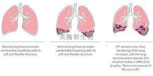 安徽专门做肺纤维化模型有哪家,肺纤维化模型