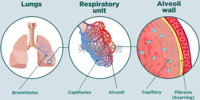 甘肃大鼠肺纤维化模型如何构建,肺纤维化模型