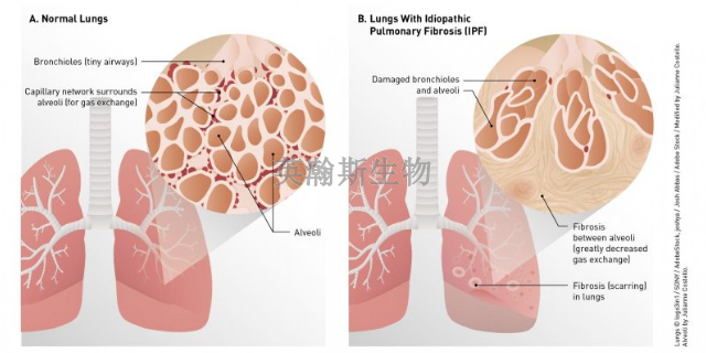 甘肃大鼠肺纤维化模型如何构建,肺纤维化模型