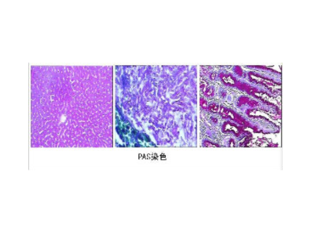 江苏咨询糖原染色试剂盒直销价,糖原染色试剂盒